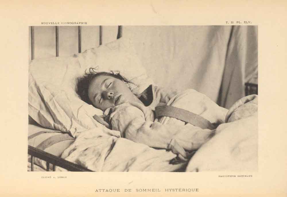Uma paciente diagnosticada com histeria contida por uma camisa de força - Fonte: Science and Media Museum
