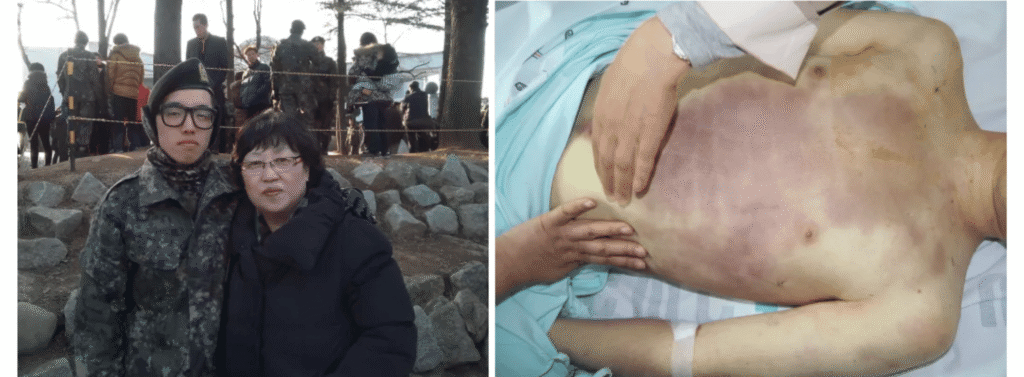 Soldado sul-coreano Yoon Seung-joo e sua mãe no alistamento militar e, à direita, o corpo de Yoon Seung-joo cheio de hematomas
